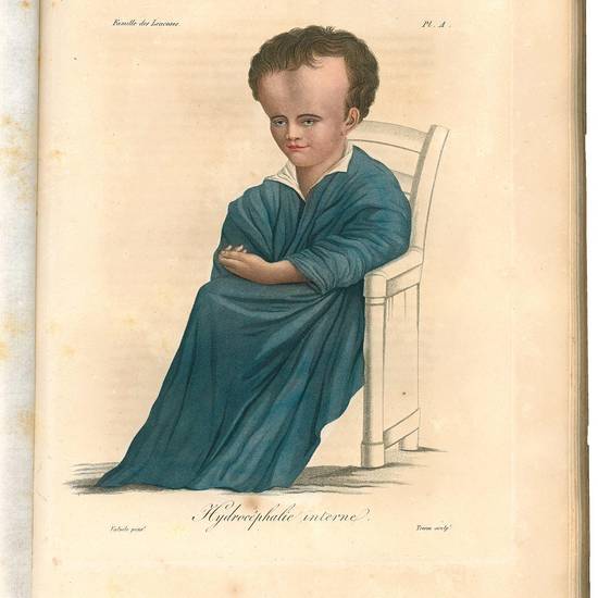 Nosologie naturelle ou les maladies du corps humain distribuées par familles [?] avec 33 planches coloriees. 1817
